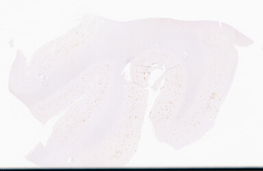 ['deident_6f74f852-a1c4-49cf-ac3e-355a63732c33_69d94200.jpg']