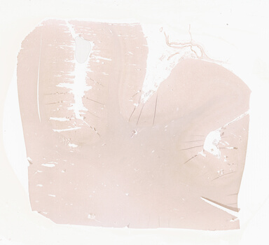 ['deident_65f951db-fb72-4b19-9db6-014d138963da_69d941f6.jpg']