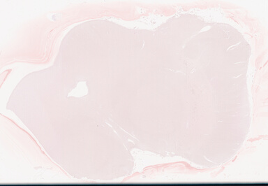 ['deident_90aa6d6b-c104-45fe-a1b7-4d43d89c793f_69d9420e.jpg']