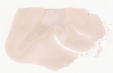['deident_2b1fe7b5-59b0-4e8f-85a0-6f288e0d7b0c_69d941dc.jpg']