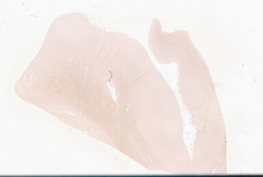 ['deident_86267643-65dc-423c-a8d7-c0f40e13c55e_69d94209.jpg']