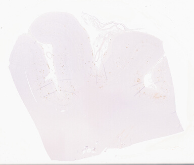 ['deident_9cebca79-1f5b-4b98-950f-1963b3dd89a8_69d94213.jpg']