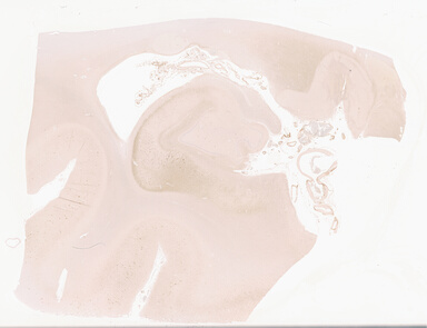['deident_a9bce7e9-7927-4d28-ba4c-d1bea4b4f29f_69d94215.jpg']