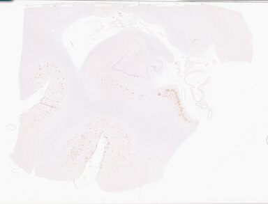 ['deident_cd2328d6-2806-40a0-8f21-e15ca6840730_69d9421d.jpg']