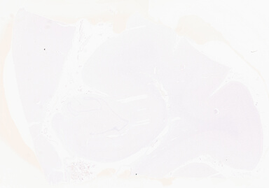 ['deident_0a402fe4-d246-44e6-a55c-a3fb534cf6b0_69d941cc.jpg']