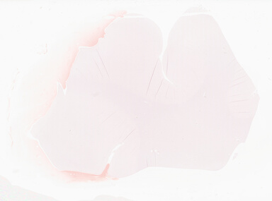 ['deident_34ae4db8-c38a-485b-97ce-3be91ccfc32f_69d941e1.jpg']
