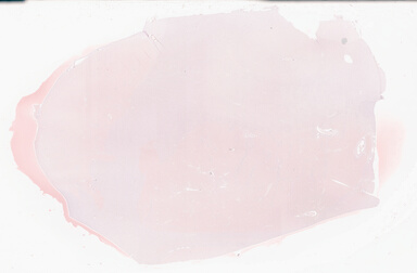 ['deident_c18ceb4e-7977-4d30-9986-665590c5f6bc_69d940c0.jpg']