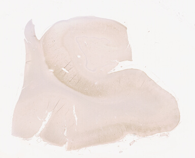 ['deident_cfec594d-d96a-4f2e-85a9-d59a22af75c1_69d940ce.jpg']