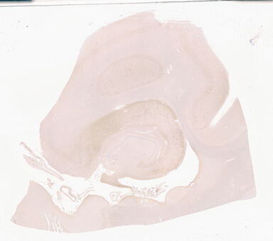 ['deident_9cd3daf9-e3e2-4e15-872a-a49a3982f380_69d940a8.jpg']