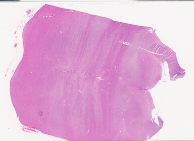 ['deident_5e07f79d-d736-425f-bf4c-1b15a16aa070_69d94096.jpg']