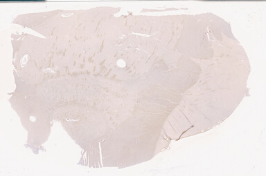 ['deident_1b8c90a4-897f-404b-ab53-5e204f20a765_69d94081.jpg']