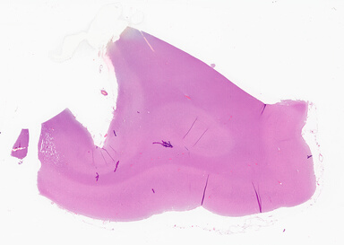 ['deident_4aa11142-7bdc-437d-8923-31fea13ad0aa_69d9408f.jpg']