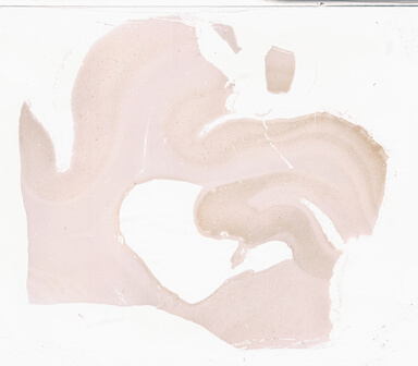 ['deident_b70d23b0-53e5-4fe5-89bf-bef296daf8c6_69d940b5.jpg']