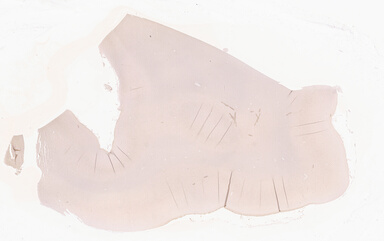 ['deident_b4e28dfd-135a-49e1-9546-6e9e67b50b11_69d940b3.jpg']