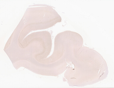 ['deident_2ebb48a9-0016-4218-8ede-3b6ba3342890_69d94085.jpg']