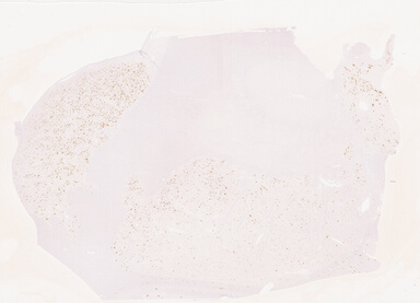 ['deident_085eb3d0-06ab-4c9b-a312-52c7445dc966_69d94076.jpg']