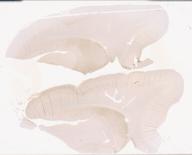 ['deident_7f4259c1-0e82-4500-b7e7-04b8f15f5fb9_69d9409e.jpg']