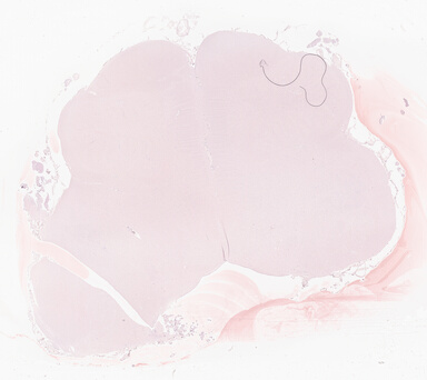 ['deident_814be927-8d06-4c65-9b73-a103af554fcd_69d940a0.jpg']