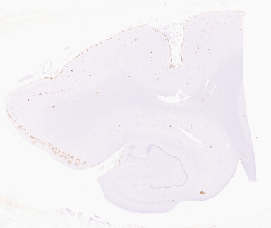 ['deident_10aa5b89-9141-4715-a1d8-7a88d427e840_69d9407c.jpg']