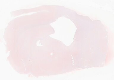 ['deident_af088ce6-51c2-4def-b09d-2bde42d393a5_69d940b1.jpg']