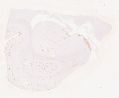 ['deident_fdf9f5bb-25f6-49ed-9ade-5e02912b92bf_69d940de.jpg']