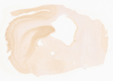 ['deident_1b3d0797-405c-44ab-b7cd-ca3cb7583bbc_69d94080.jpg']