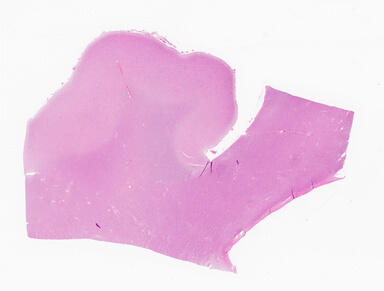 ['deident_3216c535-0422-40bb-ae95-dc653e8c3797_69d94087.jpg']