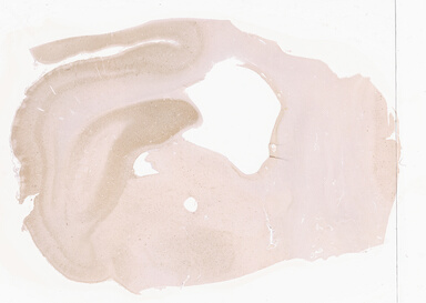 ['deident_f53d0ec0-c44d-4029-9980-bcdefef2d7e4_69d940da.jpg']
