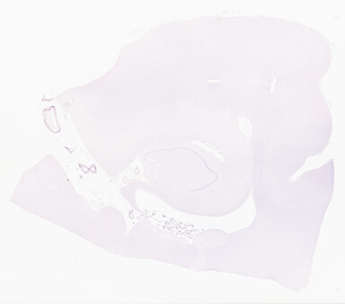 ['deident_3ecb5583-1a3a-48c4-9467-9a49e8bab456_69d9408c.jpg']