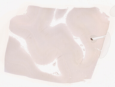 ['deident_fb9c0a46-fea3-450a-ae5d-4016462e4a6f_69d940dc.jpg']
