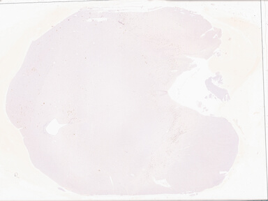 ['deident_413cd55b-e22a-479a-8030-89c48cdc828b_69d9408d.jpg']