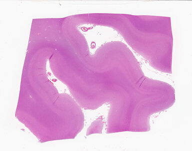 ['deident_0ac04460-b284-4e43-bac8-7dbaf303df22_69d94078.jpg']