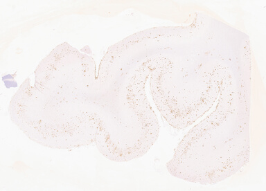 ['deident_cd9f1a48-43f0-4272-bb8e-535b7b187675_69d940cc.jpg']