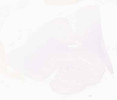 ['deident_b8b74f25-8d0e-40c1-bb10-a3e7b70509f9_69d940b8.jpg']