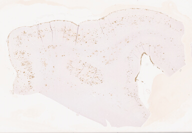 ['deident_cb8fe007-b102-426c-bba6-ff755deda72b_69d940ca.jpg']