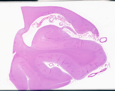 ['deident_45cb546d-2ae3-4357-82f4-49eecd8116cd_69d94d84.jpg']
