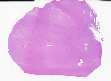 ['deident_fda4a2dd-7cc8-4435-aca4-2a346a6d72bf_69d94dd7.jpg']