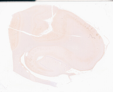 ['deident_fb63ae55-b6bb-43f9-bdb6-286a4d162e9d_69d94dd3.jpg']