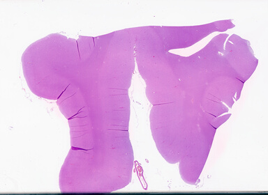 ['deident_069c1fba-6de5-498c-aea6-5f1431ecaf88_69d94d63.jpg']