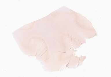 ['deident_8d85f4ee-c5f3-43a1-9d22-2867c24e178f_69d94db0.jpg']