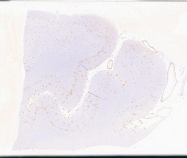 ['deident_3c50448d-8c4b-49ed-b6e9-20756c7cf90c_69d94d7b.jpg']