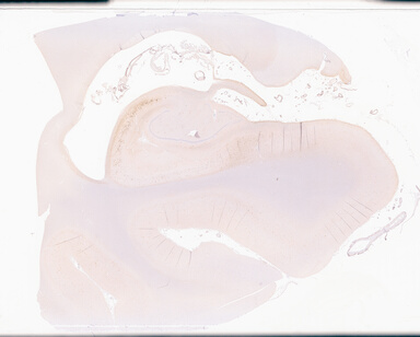 ['deident_d65e2ae2-643a-4105-a919-bea3bc5d7a5e_69d94dc3.jpg']