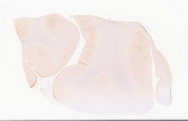 ['deident_feb500a8-39da-4801-b74f-43d2a0559a88_69d94dd9.jpg']