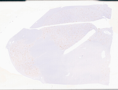 ['deident_b94140b0-4a4d-452a-b1bc-9734797560b9_69d94dbb.jpg']
