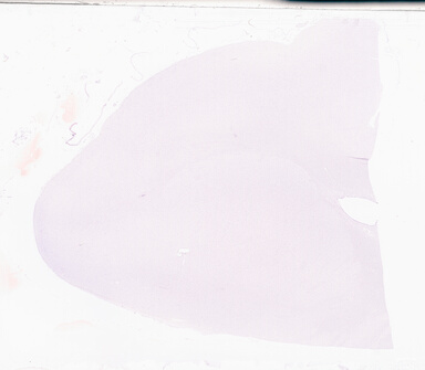 ['deident_41b942ee-35d8-4028-b499-b1fd0c1c0060_69d94d7e.jpg']