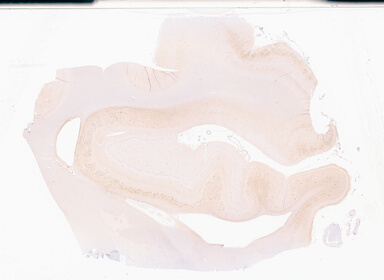 ['deident_4af94668-dbbf-4755-a937-6399adbd56a0_69d94d8a.jpg']