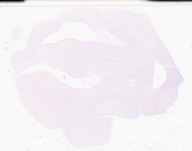 ['deident_08a19c66-c1cf-4a7d-8a87-4435eb220652_69d94d65.jpg']