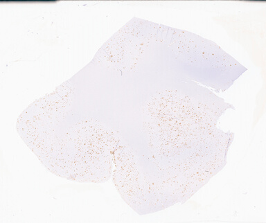 ['deident_57fa34e9-5113-4481-85ab-300c471d7a62_69d94d95.jpg']