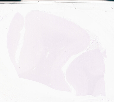 ['deident_d70aec7a-6168-41d8-930b-9c8ddb5ebac5_69d94dc5.jpg']