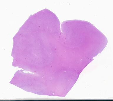 ['deident_4b740cd7-78ec-4780-85d9-9ee9e8032738_69d94d8c.jpg']